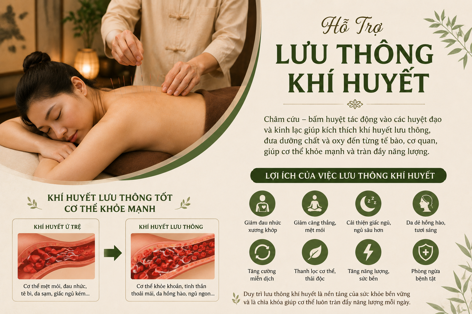 Châm Cứu Bấm Huyệt Ô Chợ Dừa - Lưu Thông Khí Huyết