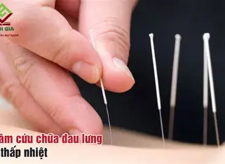 Châm Cứu Bấm Huyệt Hai Bà Trưng