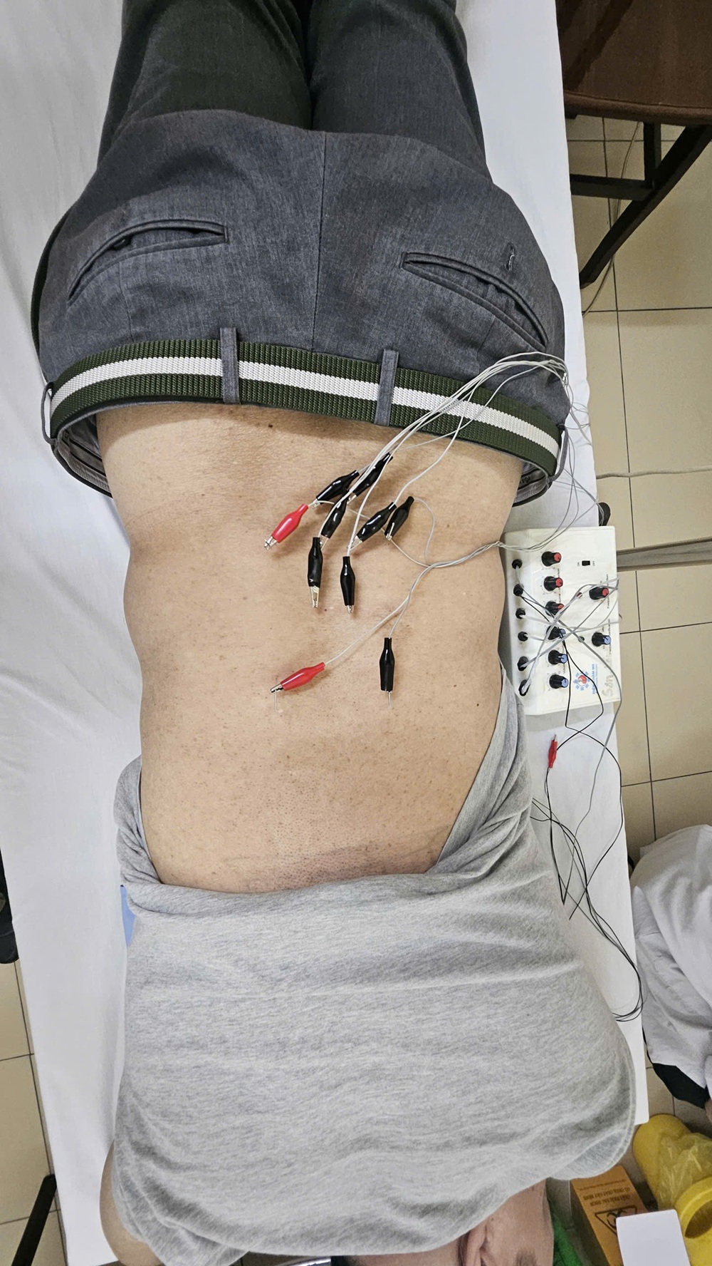 hâm Cứu Bấm Huyệt Nhà Chung tại Phòng khám Minh Phương
