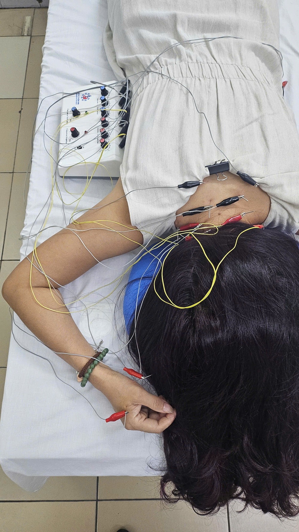 Châm Cứu Bấm Huyệt Lò Sũ Sự Kết Tinh Hoàn Hảo Của Y Học Phương Đông