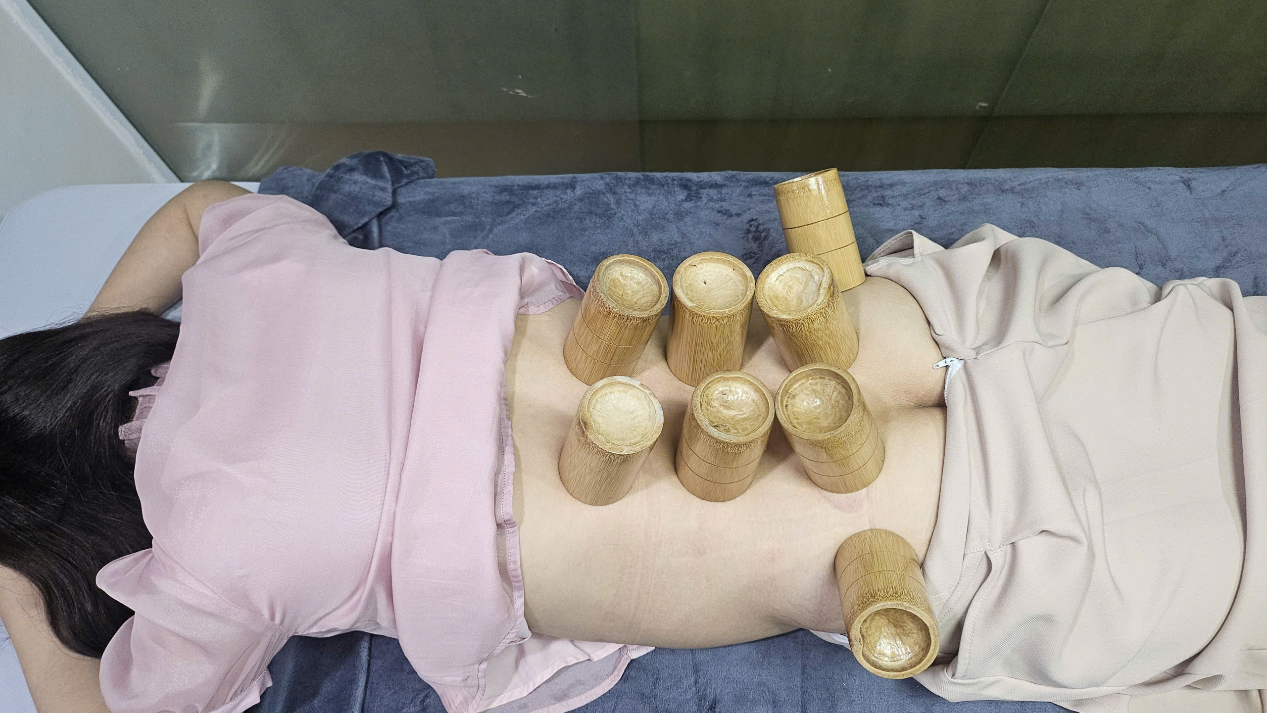 Châm Cứu Bấm Huyệt Nhà Thờ